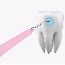 Pulizia dentale | Rimozione Dentale del Tartaro