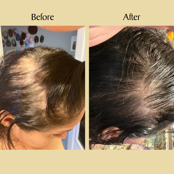 Olio Naturale Per La Crescita Dei Capelli - Salute Farma