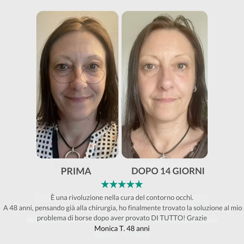 Dispositivo LED Rosso Viso – Lifting & Anti-Rughe per Pelle Più Soda