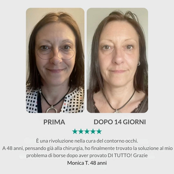 Dispositivo LED Rosso Viso – Lifting & Anti-Rughe per Pelle Più Soda