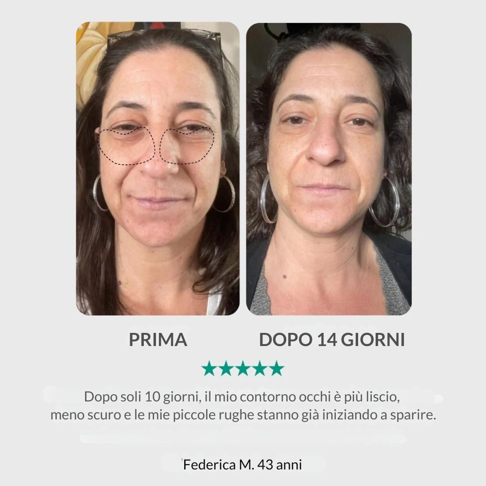 Dispositivo LED Rosso Viso – Lifting & Anti-Rughe per Pelle Più Soda